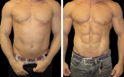 male six pack abs