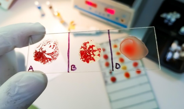 Blood Group Test