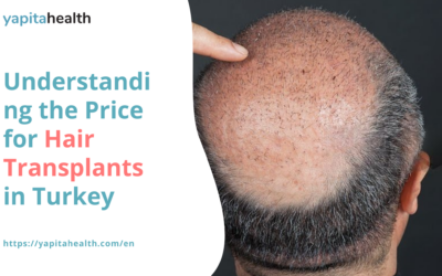 Hair Transplant in Turkey