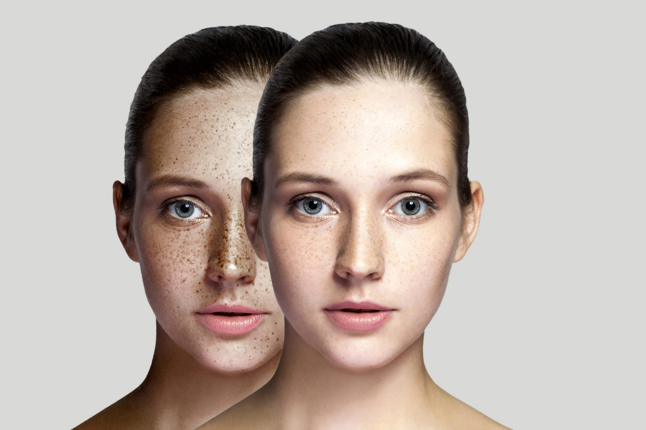 Under Standing Pigmentation and Its types and causes