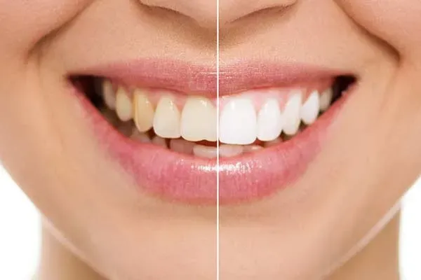 Cosmetic dentistry in New York