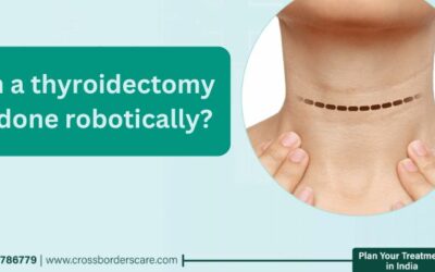 robotic thyroidectomy procedure in Delhi