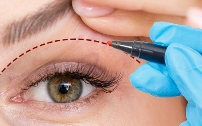 Eyelid Surgery in Islamabad