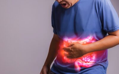 Ulcerative Colitis