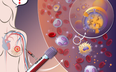 Breast Cancer Liquid Biopsy