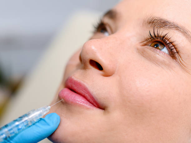 Dermal filler in Abu Dhabi