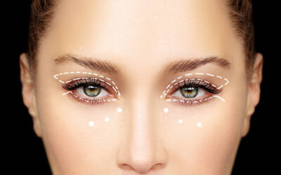 Eyelid surgery in Abu Dhabi