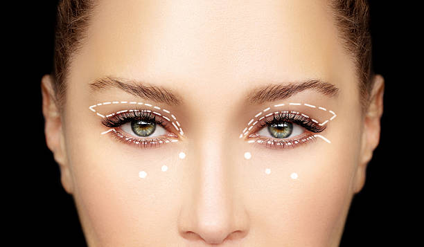 Eyelid surgery in Abu Dhabi