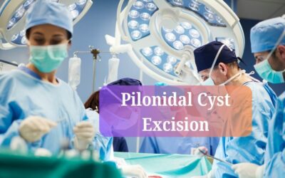 pilonidal cyst excision