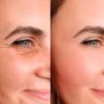 How Much Does Botox Cost in Dubai? Pricing, Clinics & What to Expect