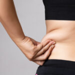 Liposuction in Dubai