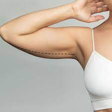 Arm Lift in Jeddah for Sleeker, Firmer Upper Arms