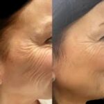 Best Plastic Surgeon in dubai
