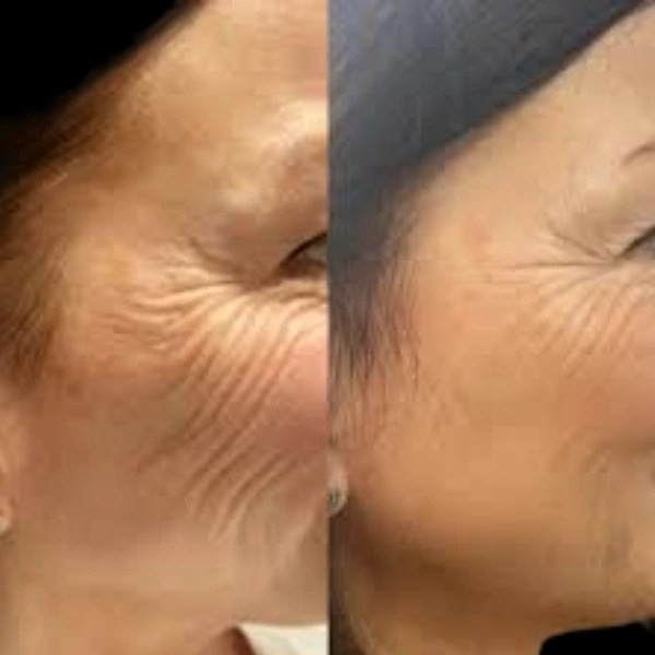 Best Plastic Surgeon in dubai