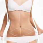 Best tummy tuck surgeon in dubai