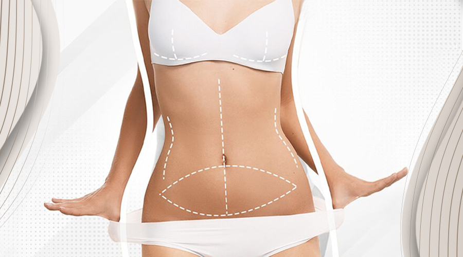 Best tummy tuck surgeon in dubai
