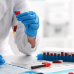 Neutralizing Antibody Assay