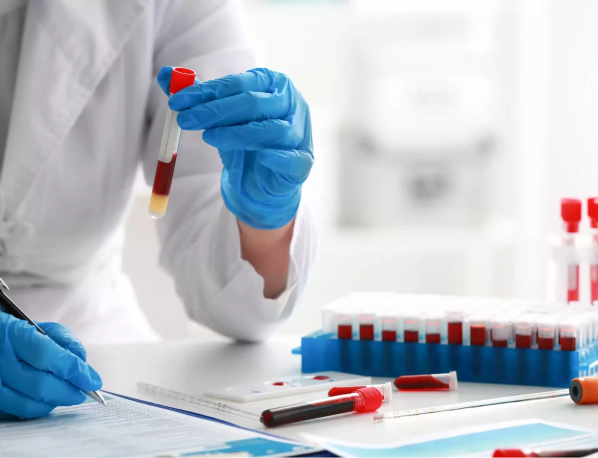 Neutralizing Antibody Assay