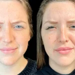 Best Aesthetic Clinic in Dubai: Trends in Anti-Aging Treatments You Should Know