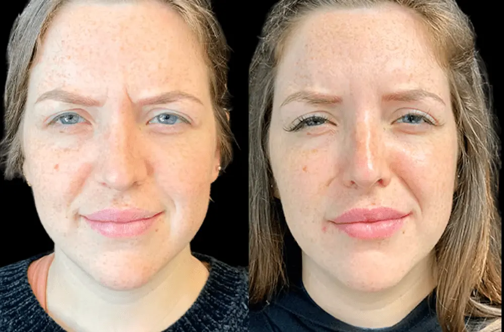 Best Aesthetic Clinic in Dubai: Trends in Anti-Aging Treatments You Should Know