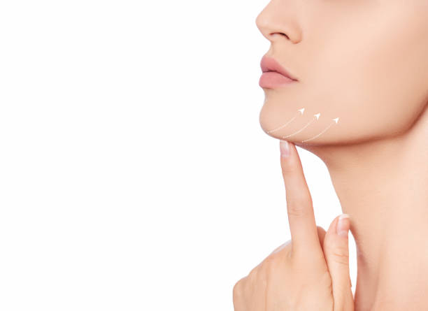 Neck Lift in Jeddah to Enhance Jawline and Neck Contours