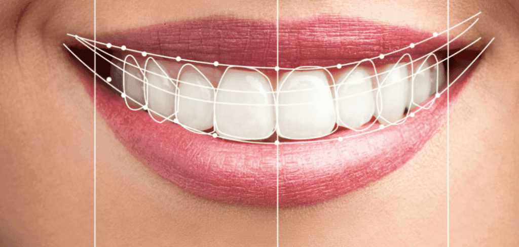 Digital Smile Design Dubai