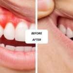 Orthodontic Dentistry in Dubai: Modern Alignment Solutions Using Braces and Clear Aligners
