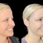From Consultation to Results: Your Journey with the Best Aesthetic Clinic in Dubai
