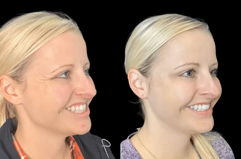 From Consultation to Results: Your Journey with the Best Aesthetic Clinic in Dubai