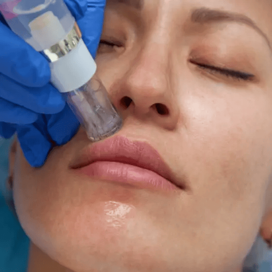 face rejuvenation in jeddah