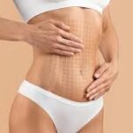 vaser liposuction in dubai