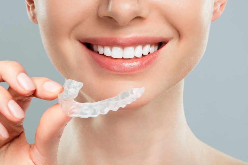 Invisalign Dubai