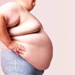 Choosing the Right Clinic for Obesity Treatment Dubai