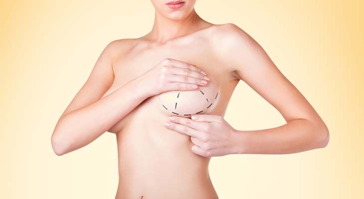 Breast Augmentation in Dubai for Confident Body Shape