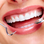 Dental Tooth Filling Dubai for Healthy Teeth