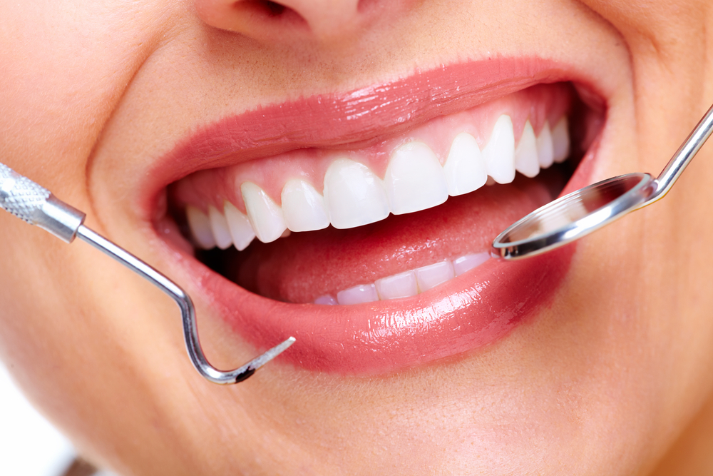 Dental Tooth Filling Dubai for Healthy Teeth