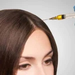 Prp Hair Treatment in Dubai and Hair Transplant in Dubai Restoring Thickness Strength Density
