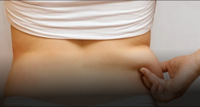 Back Liposuction In Dubai