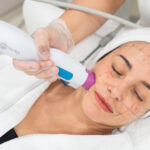 Results Timeline for Thermage Skin Tightening in Dubai