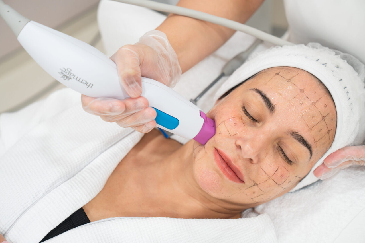 Results Timeline for Thermage Skin Tightening in Dubai