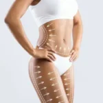 Sixpack Liposuction in Dubai