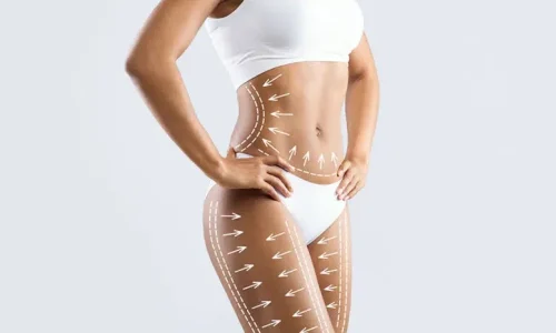 Sixpack Liposuction in Dubai