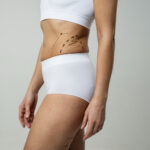 Liposuction in Dubai
