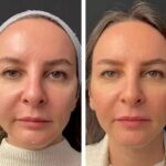 Best Aesthetic Clinics in Dubai for Personalized Skin Care Plans