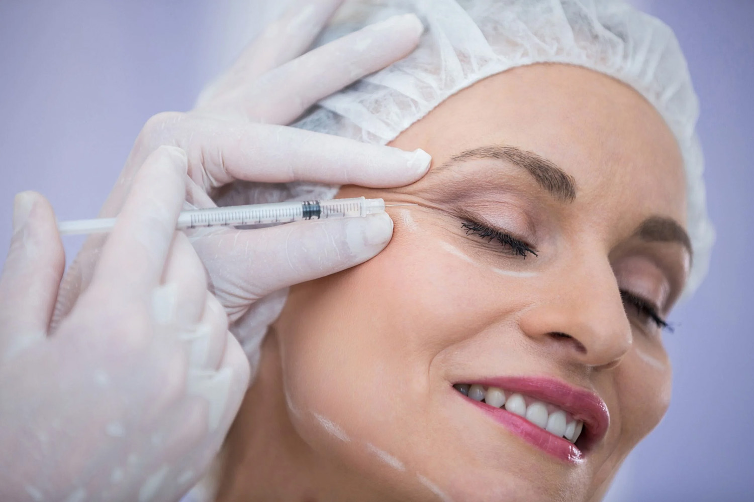 Face Fillers vs Botox in Dubai: Which is Better?