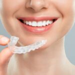 Invisalign Dubai: Clear Aligners for Teeth Straightening