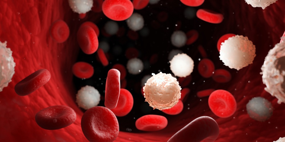Anemia Dubai: Recognizing the Early Signs and Symptoms