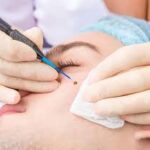 Skin Tags Removal in Dubai: Safe and Effective Skin Refinement