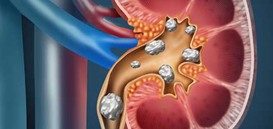 7 Ways Energy Drinks May Be Affecting Kidney Health More Than You Realise 