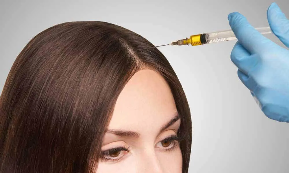 Combining PRP Hair Treatment in Dubai with Hair Transplant in Dubai Procedures